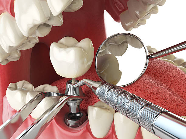 Best Emergency Dental Services for Seniors in Woody, WA